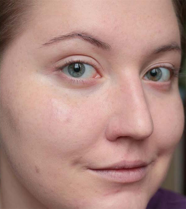 Очищение кожи